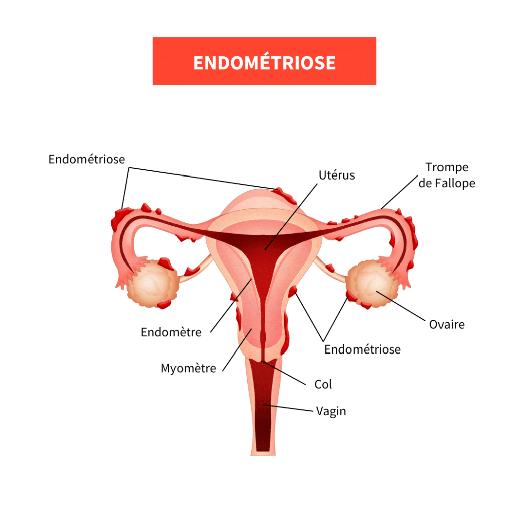 Votre texte de paragraphe